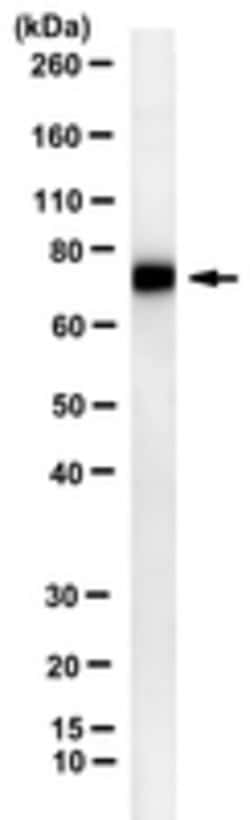 Adenylate Cyclase Toxin Mouse anti-Bacteria, Clone: 3D1, MilliporeSigma:Antibodies:Primary